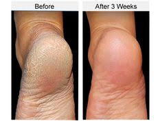 aura lotion